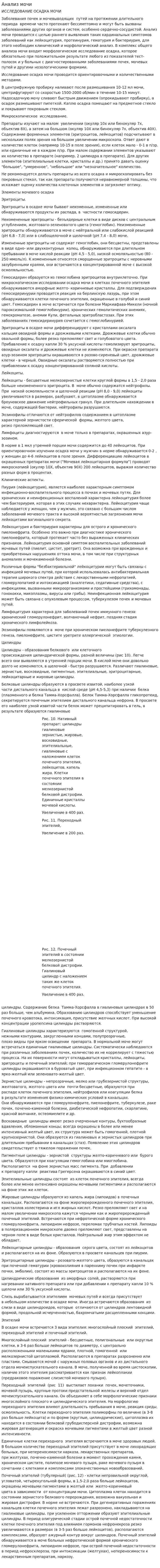 Анализ мочи