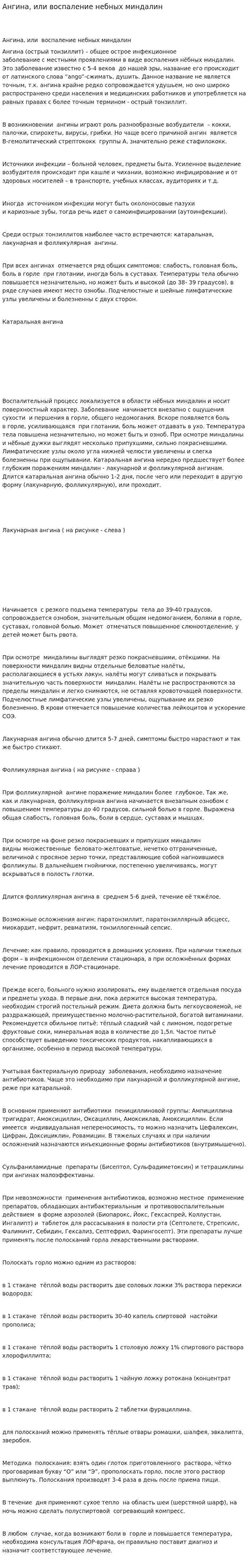 Ангина, или воспаление небных миндалин