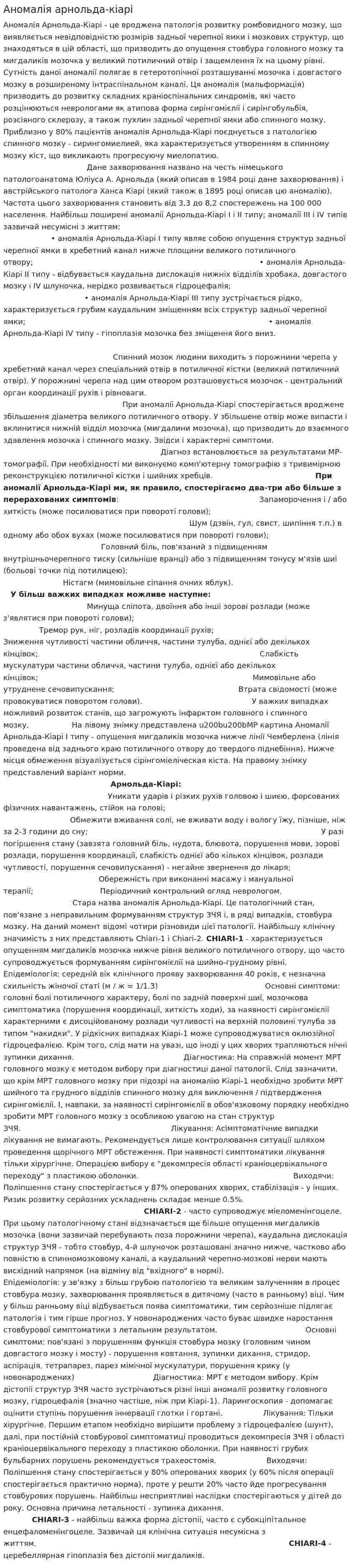 Аномалія арнольда-кіарі