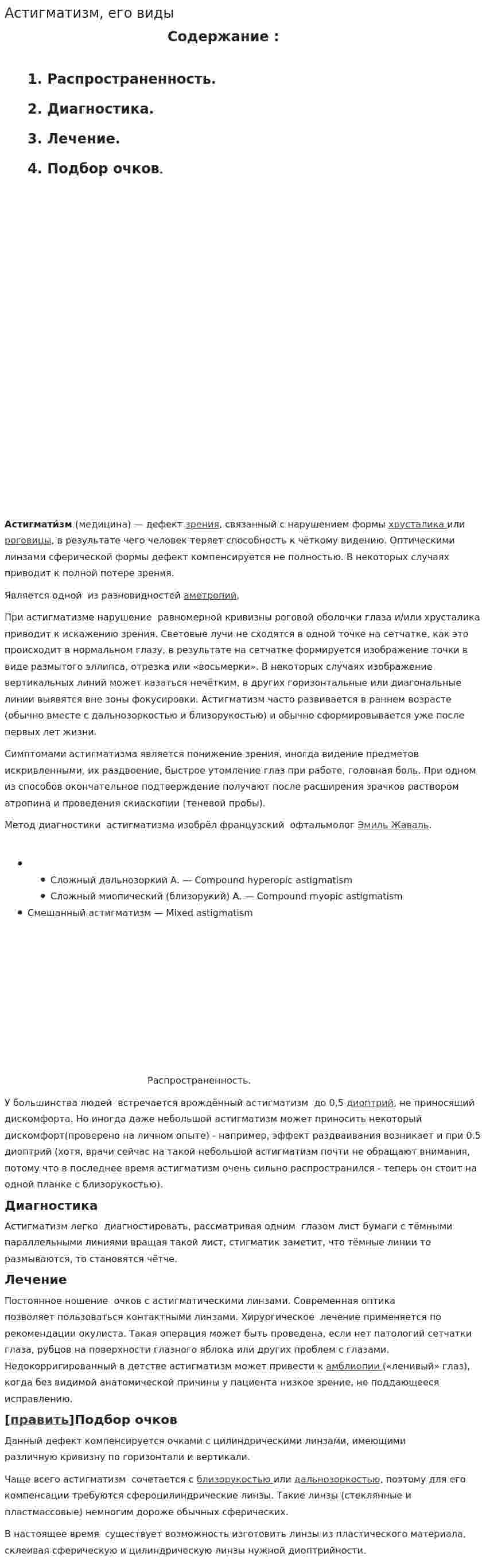Астигматизм, его виды