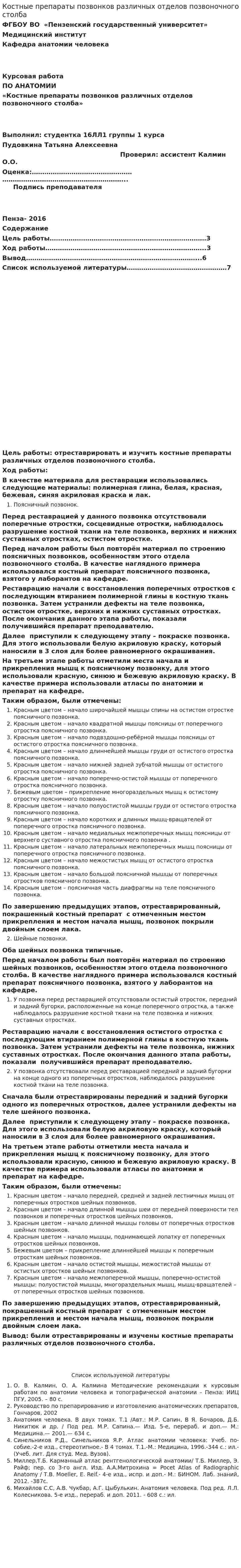 Костные препараты позвонков различных отделов позвоночного столба