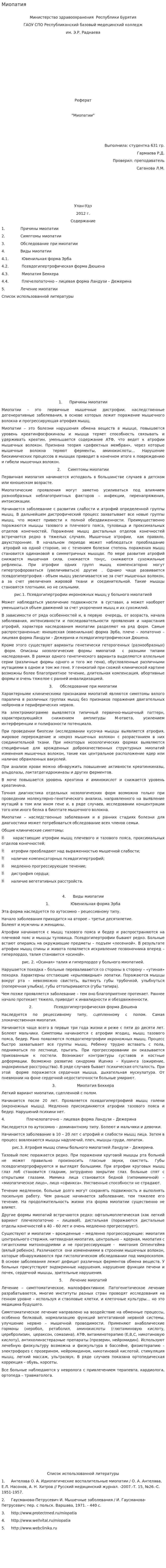 Миопатия