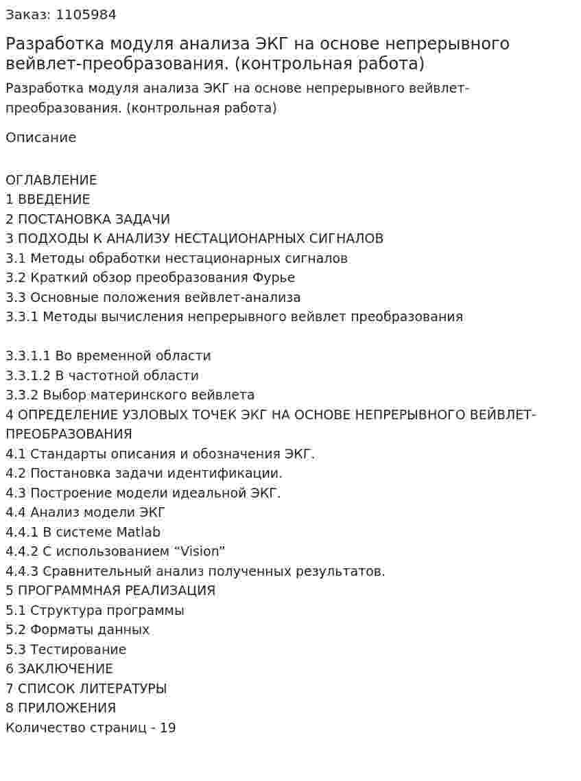 Разработка модуля анализа ЭКГ на основе непрерывного вейвлет-преобразования. (контрольная работа) 
