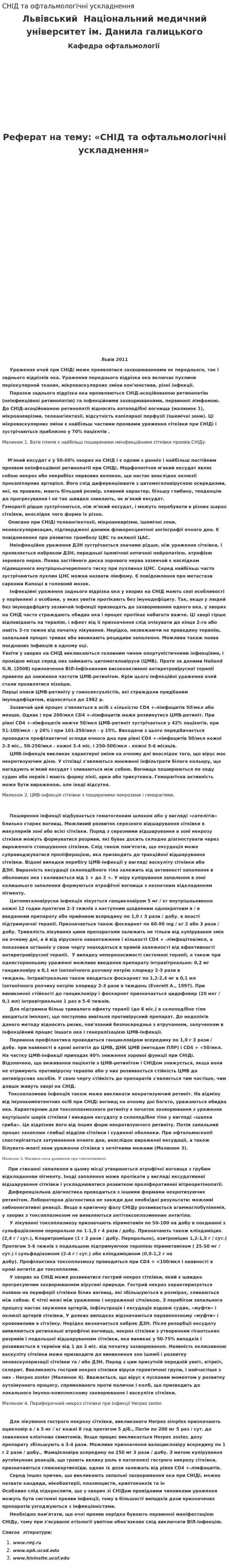 СНІД та офтальмологічні ускладнення
