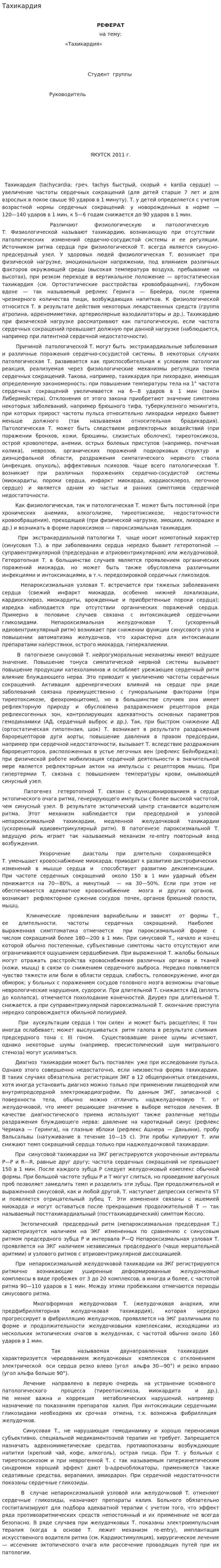 Тахикардия